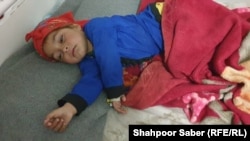 یکی از اطفال مبتلا به بیماری سرخکان در شفاخانه ولایت بادغیس