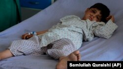 کودک زخم برداشته در نتیجه جنگ در افغانستان